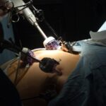 Essentialities Of CBD Oil For Removing Pain In Dogs